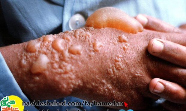 یادمان شهدای شیمیایی گردان فجر بهبهان؛ تجدید میثاق با حماسه، ایثار و مظلومیت